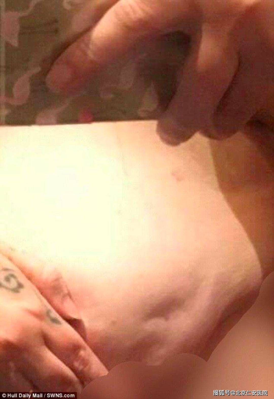 秦岭发现新物种，秦岭缺翅螳，探索自然美景的震撼之旅