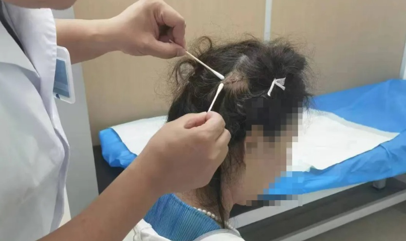 戴鲨鱼夹摔倒重度昏迷女子被接回家,戴鲨鱼夹摔倒重度昏迷女子被接回家，自然之旅的魅力与重要性