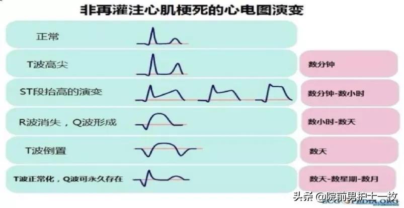 最新心电图速记口诀全解析✨
