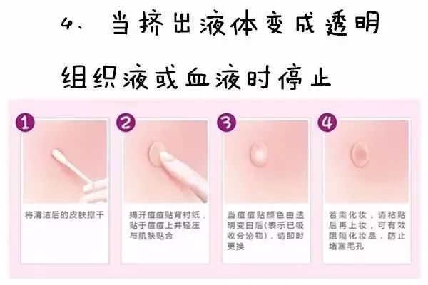最新挤脓包视频教程，初学者到进阶用户的皮肤脓包处理步骤指南