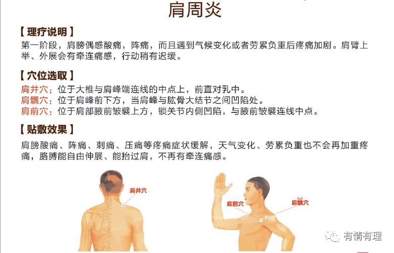 最新肚子疼视频详解，观看、理解与应对的指南