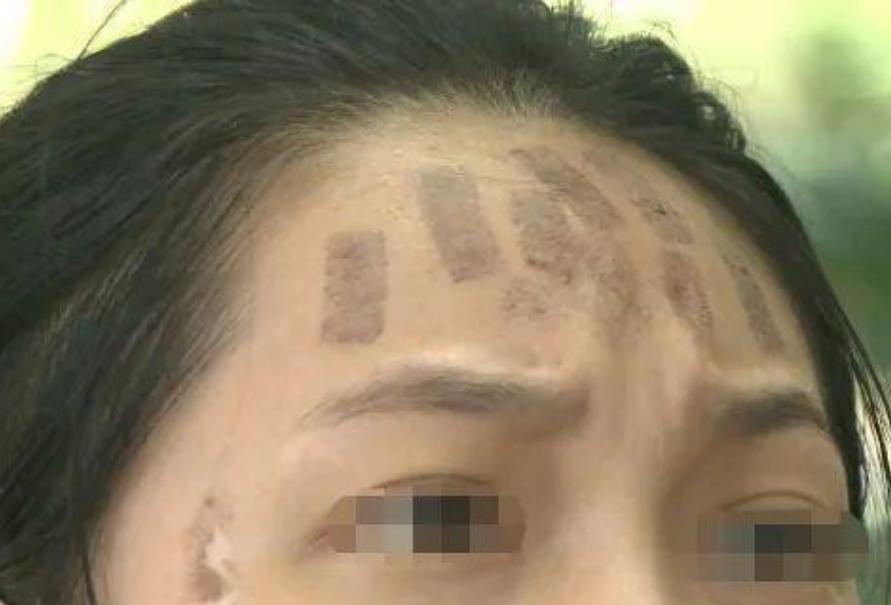 最新光子嫩肤机器，重塑自信的力量与源泉