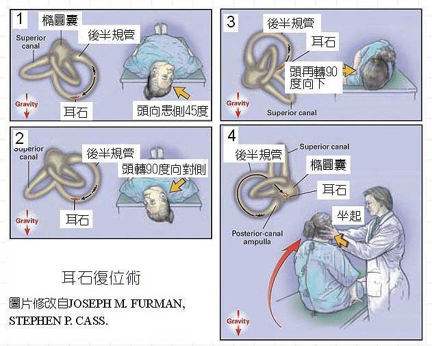 揭秘耳石最新进展及其在医学领域的重要地位